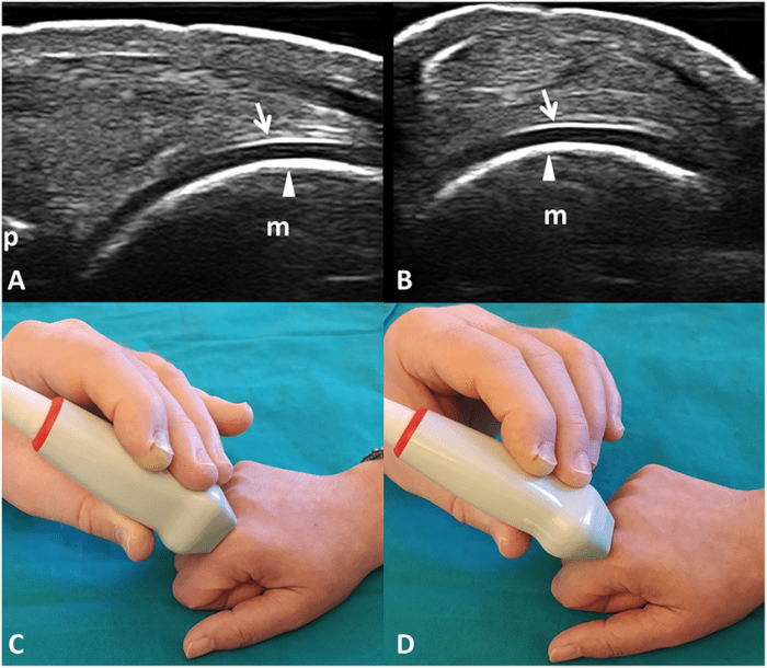 Using the key choices identify each type of cartilage described